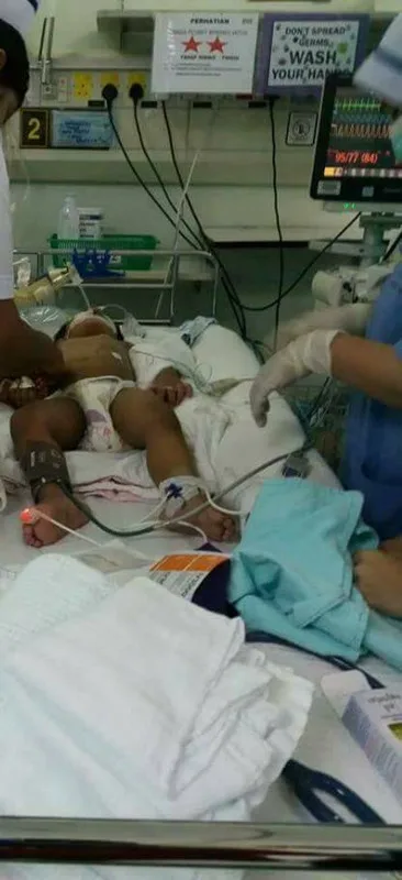 Budak Viral Dipatuk Ular Tedung Semakin Pulih